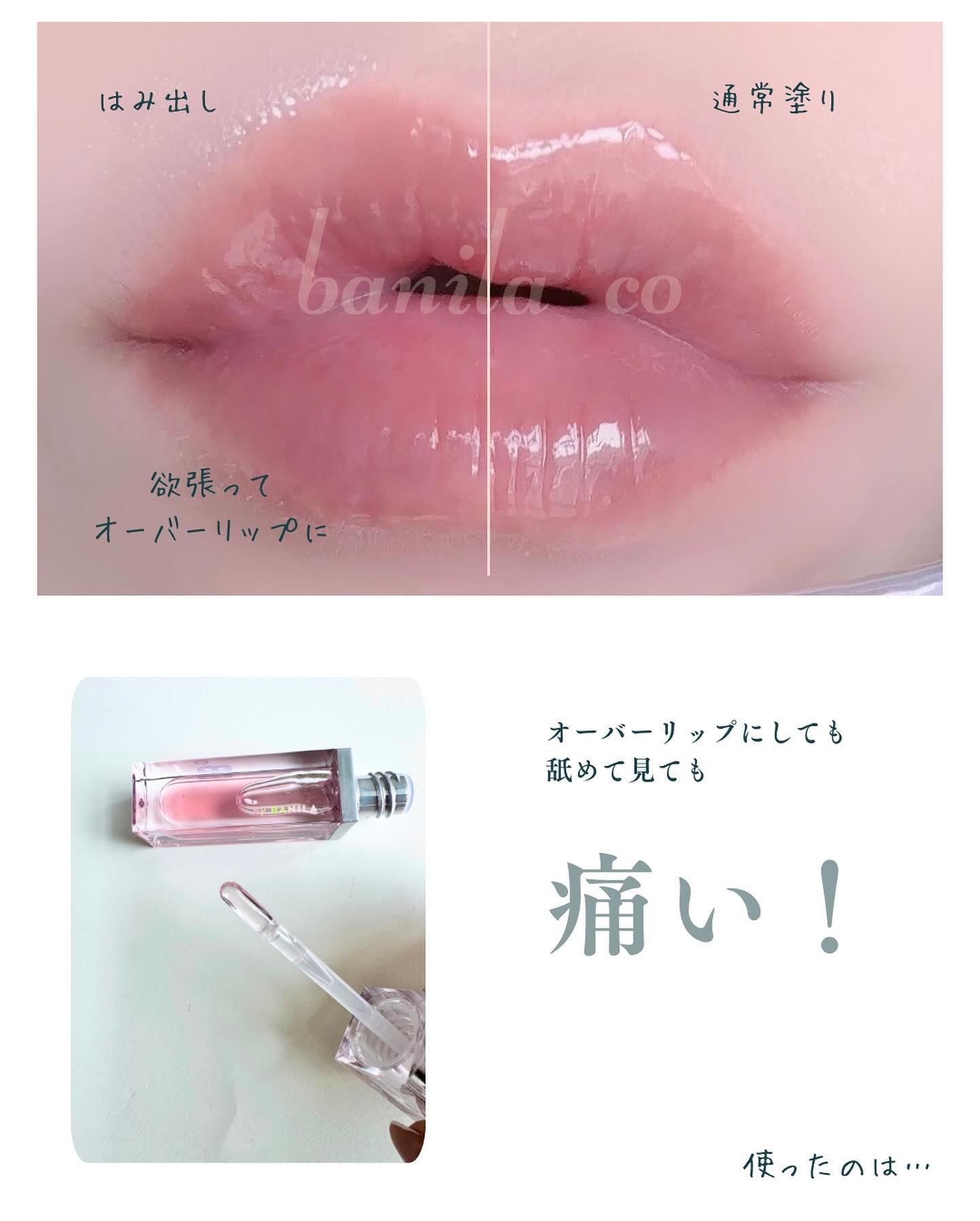 ボリュームリッププランパー/BANILA CO/リッププランパーを使ったクチコミ（2枚目）