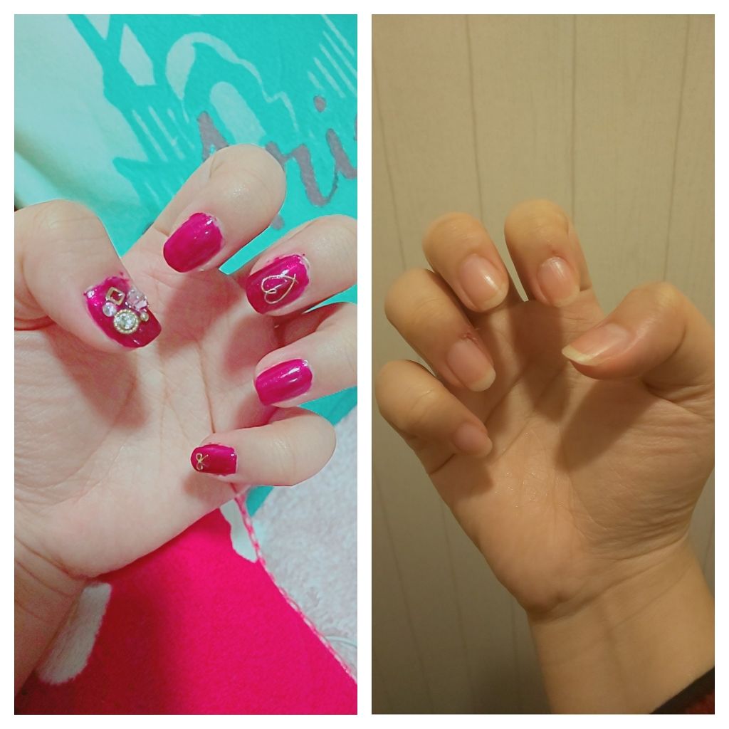 エルファー ネイルキッスC/DAISO/除光液を使ったクチコミ（2枚目）