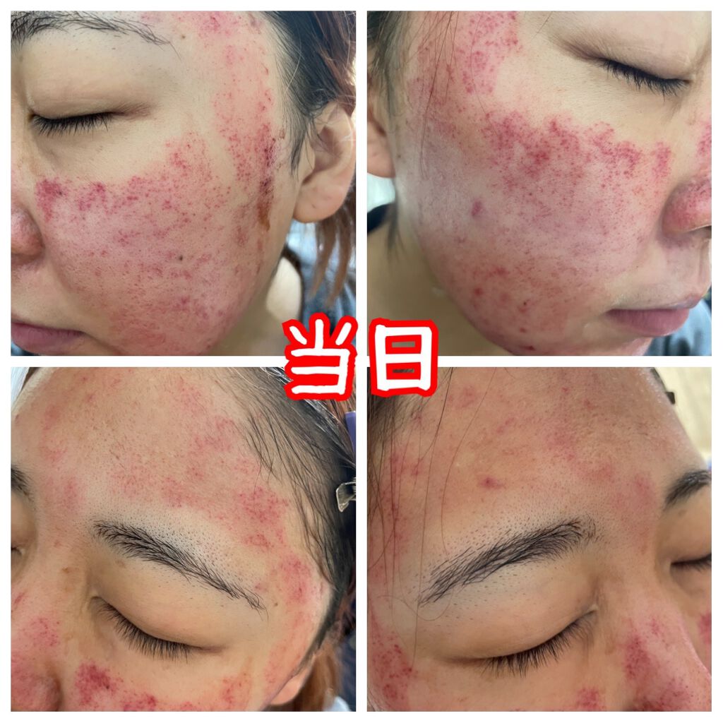 を使ったクチコミ（3枚目）