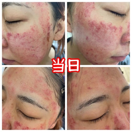 を使ったクチコミ(3枚目)