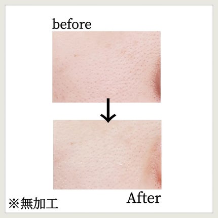 CICA デイリースージングマスク/VT/シートマスク・パックを使ったクチコミ(9枚目)