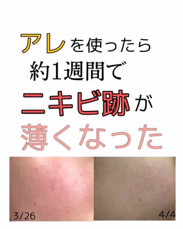 敏感肌用薬用美白美容液/無印良品/美容液を使ったクチコミ（1枚目）