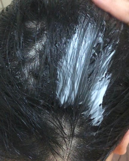 薬用スカルプケアシャンプー/トリートメント モイスト/WELLP/市販シャンプーを使ったクチコミ(6枚目)