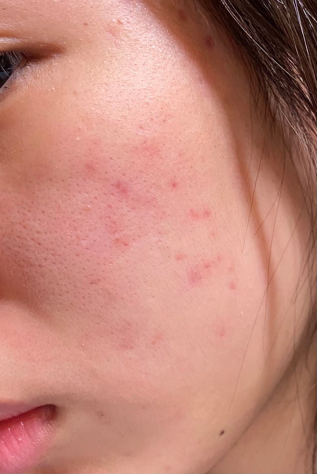 薬用美白美容液/なめらか本舗/美容液を使ったクチコミ(4枚目)