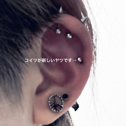 テラマイシン 軟膏(医薬品)/ジョンソン・エンド・ジョンソン/その他を使ったクチコミ(3枚目)