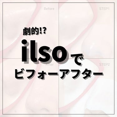 ナチュラルマイルドクリアノーズパック/ilso/シートマスク・パックを使ったクチコミ（1枚目）