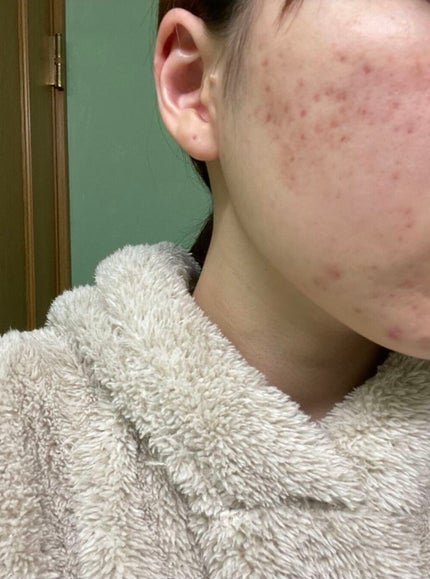 ロゼット洗顔パスタ ホワイトダイヤ/ロゼット/洗顔フォームを使ったクチコミ(1枚目)