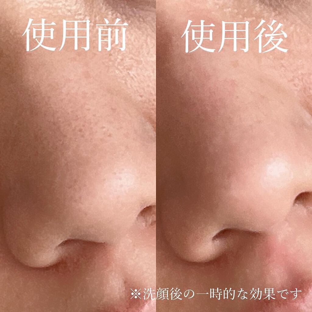 ひーこ /垢抜け メイクテク on LIPS 「音波振動の快適さにハマった〜✨『PMD』(@pmdbeaut..」(3枚目)