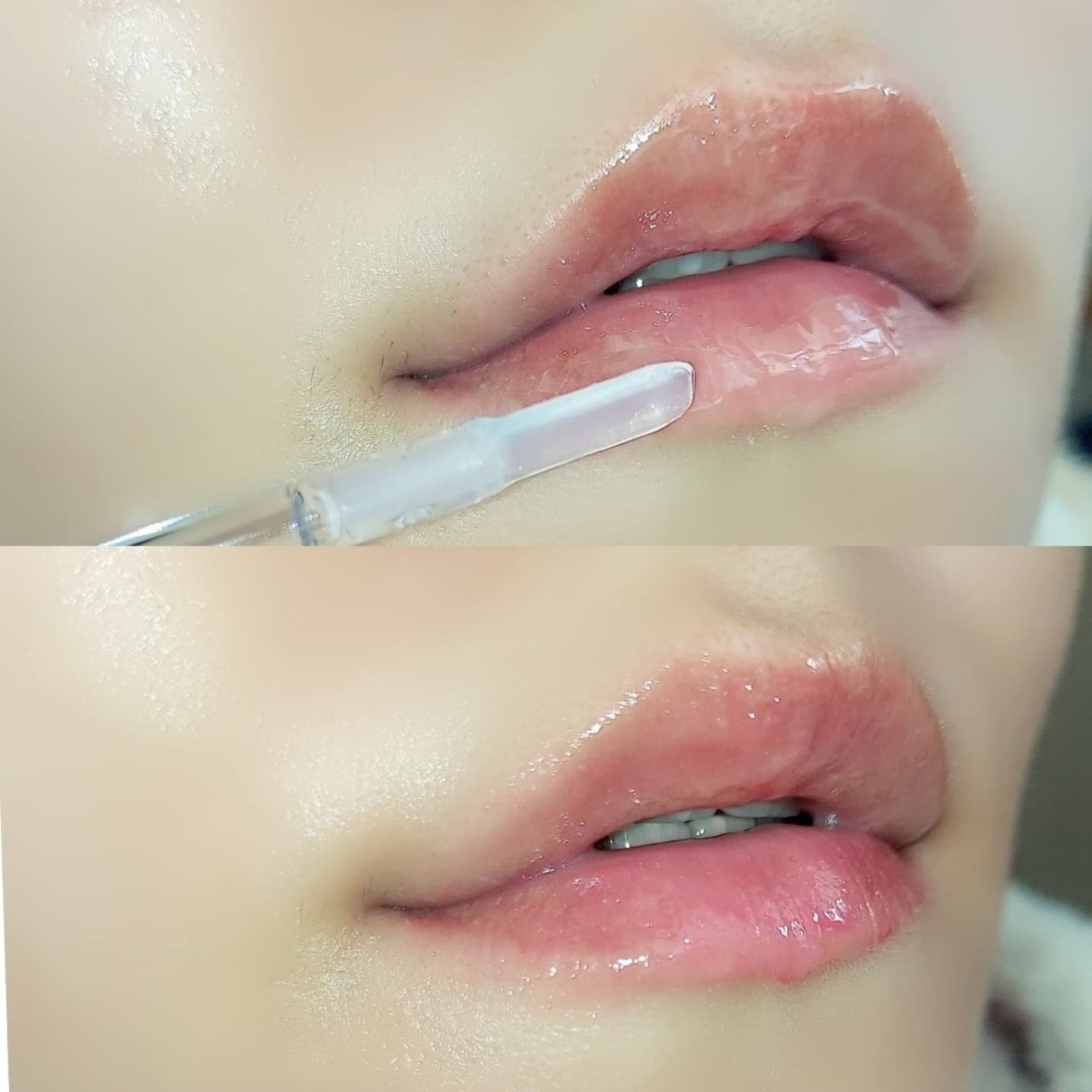 ウォーターフルリッププランパー/COSNORI/リッププランパーを使ったクチコミ(5枚目)