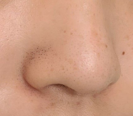 RMK Wトリートメントオイル/RMK/ブースター・導入液を使ったクチコミ(4枚目)