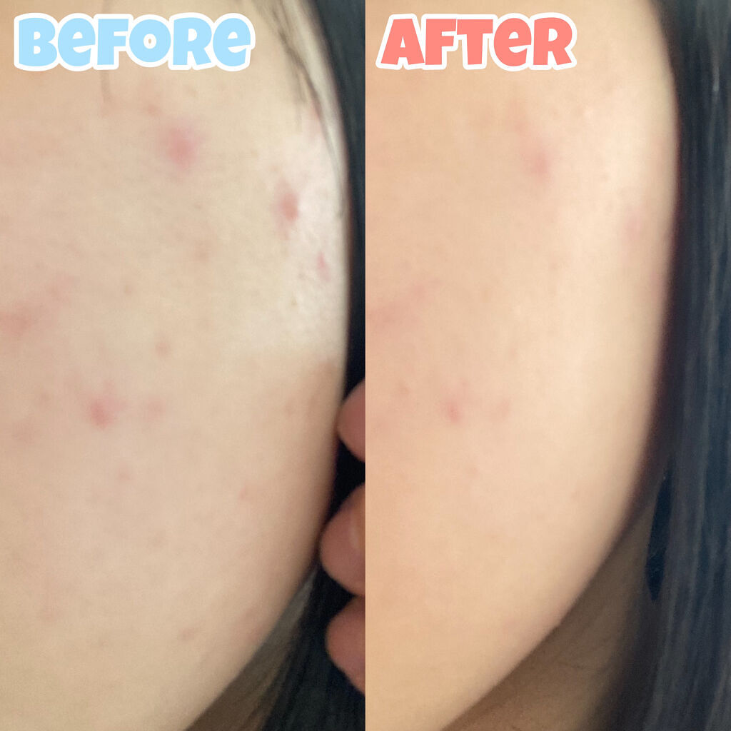 スキンティントセラム ST01 ナチュラルオークル10/excel/リキッドファンデーションを使ったクチコミ（1枚目）