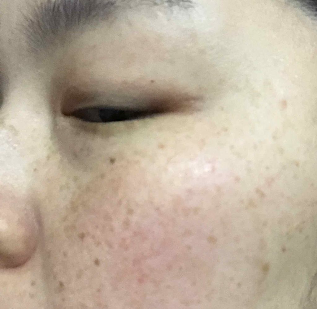 ホワイト 薬用ドットゼロ/リッツ/美容液を使ったクチコミ（2枚目）