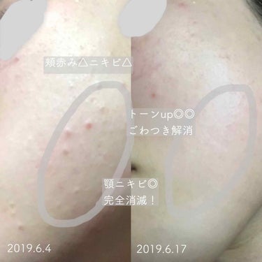 ラッシュ 俳句のクチコミ「先日投稿したラッシュの#スキンケア備忘録🧼を、
約二週間ほど継続しました！！

結論から言うと.....」（2枚目）