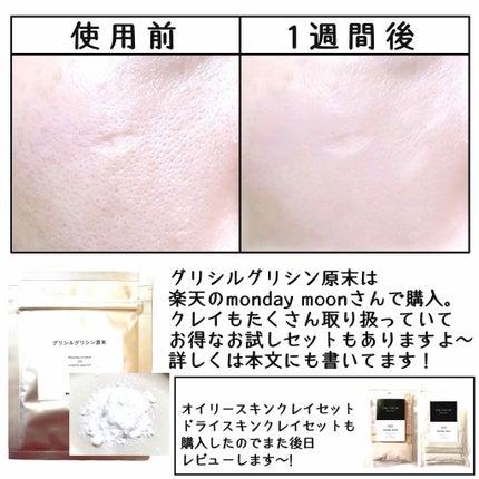 ハトムギ化粧水(ナチュリエ スキンコンディショナー R )/ナチュリエ/化粧水を使ったクチコミ(4枚目)