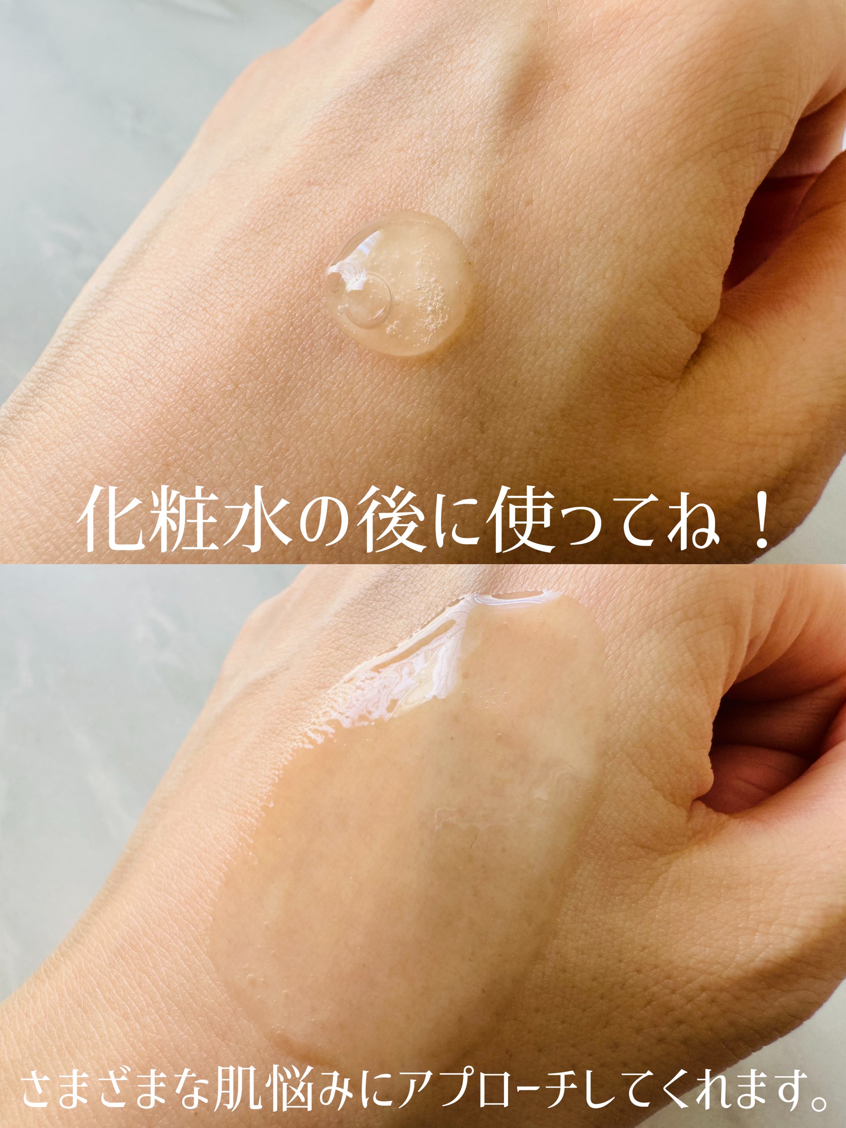 fractionalCC ニードルセラムC/fractionalCC/美容液を使ったクチコミ（2枚目）