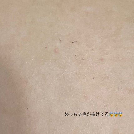 光脱毛器 VIO/Sarlisi/家庭用脱毛器を使ったクチコミ(3枚目)