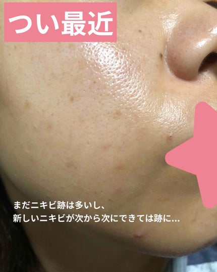 UVローション SPF50+/キュレル/日焼け止め・UVケアを使ったクチコミ(5枚目)