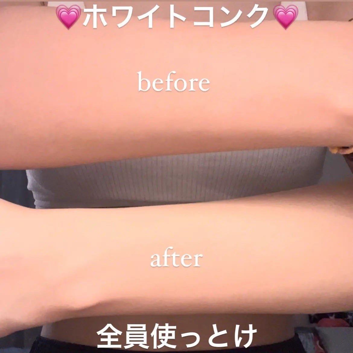 薬用ホワイトコンク ボディシャンプーC II/ホワイトコンク/ボディソープを使ったクチコミ(1枚目)