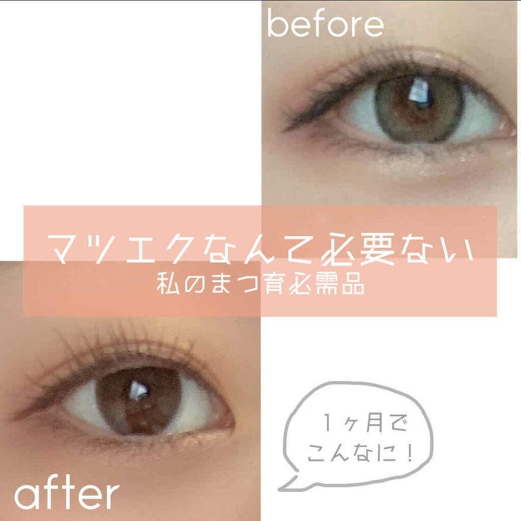 EMAKED（エマーキット）｜水橋保寿堂製薬の効果に関する口コミ