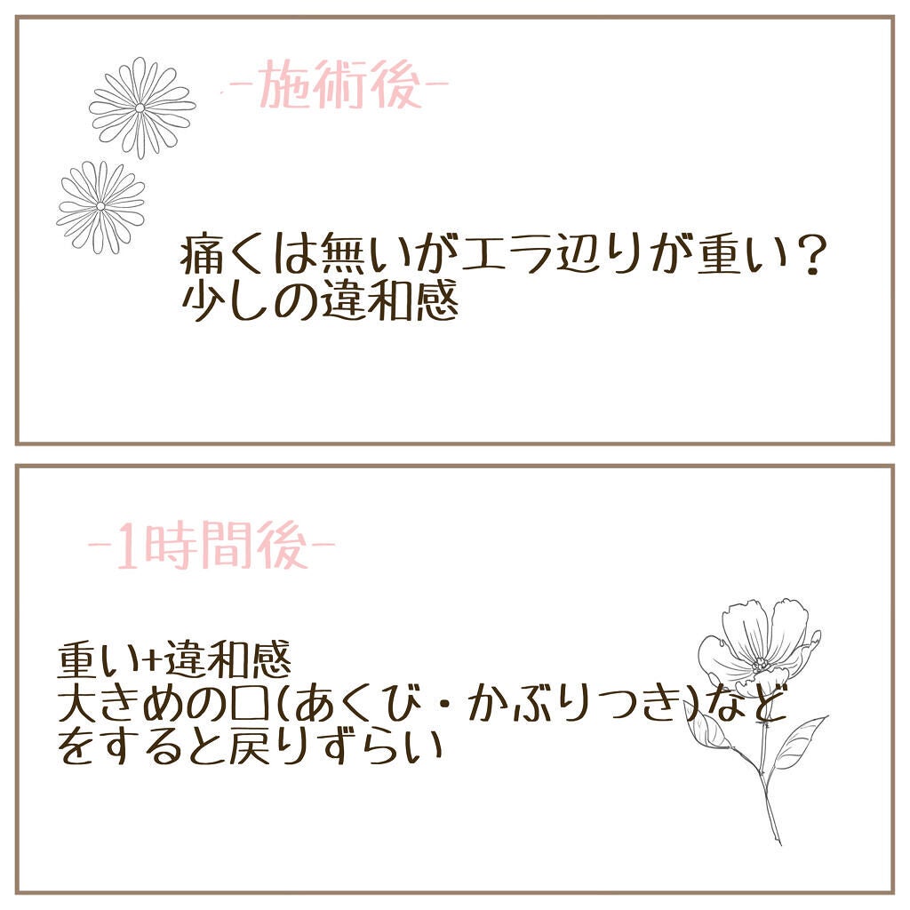 sayu on LIPS 「ずっとずっとやりたかったエラボトックス受けて来ました💓今回私は..」(4枚目)