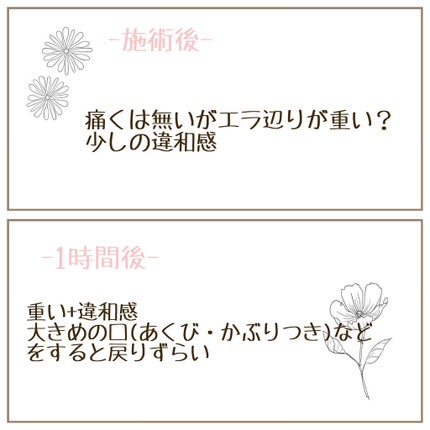 sayu on LIPS 「ずっとずっとやりたかったエラボトックス受けて来ました💓今回私は..」(4枚目)