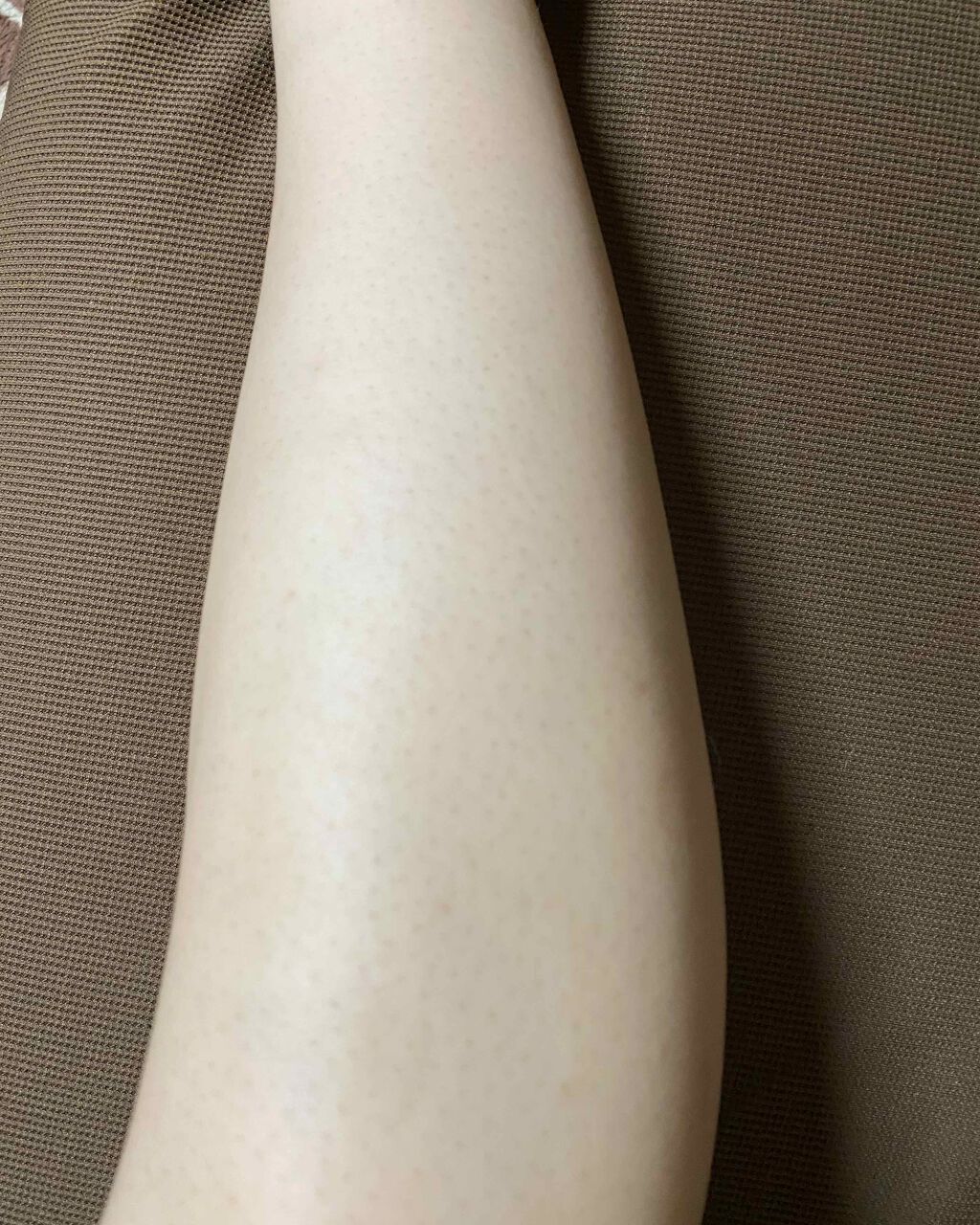 光脱毛器 VIO/Sarlisi/家庭用脱毛器を使ったクチコミ(3枚目)