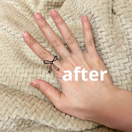 モイスト薬用ハンドクリームUR/モイスト/ハンドクリームを使ったクチコミ(3枚目)