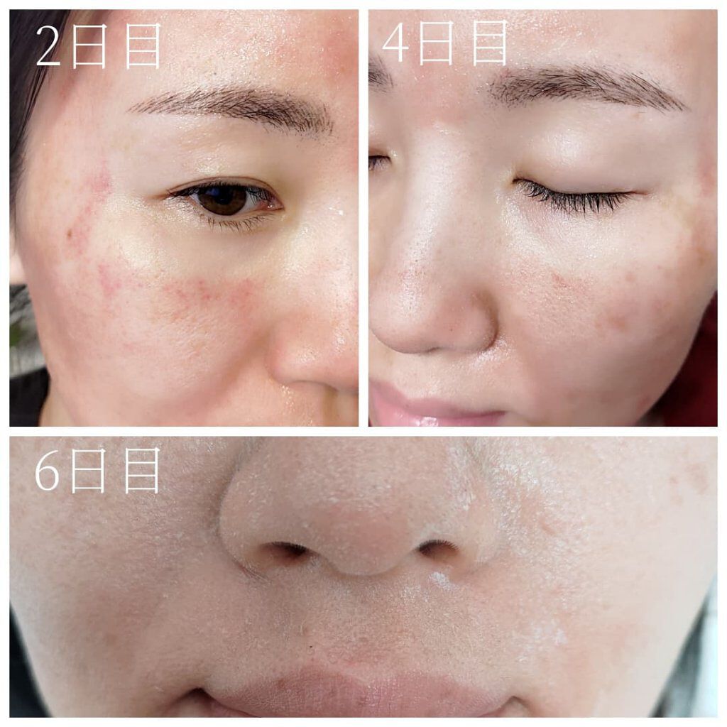 を使ったクチコミ（3枚目）