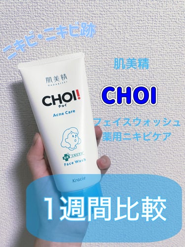 CHOI薬用フェイスウォッシュ ニキビケア ［医薬部外品］/肌美精/洗顔フォームを使ったクチコミ（1枚目）