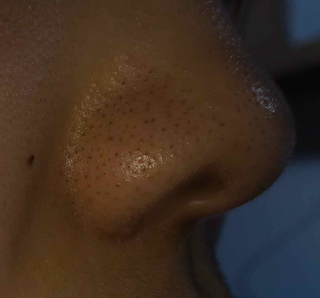 きゅる on LIPS 「開いて頂きありがとうございます🙏画像わかりにくくてすみません。..」(3枚目)