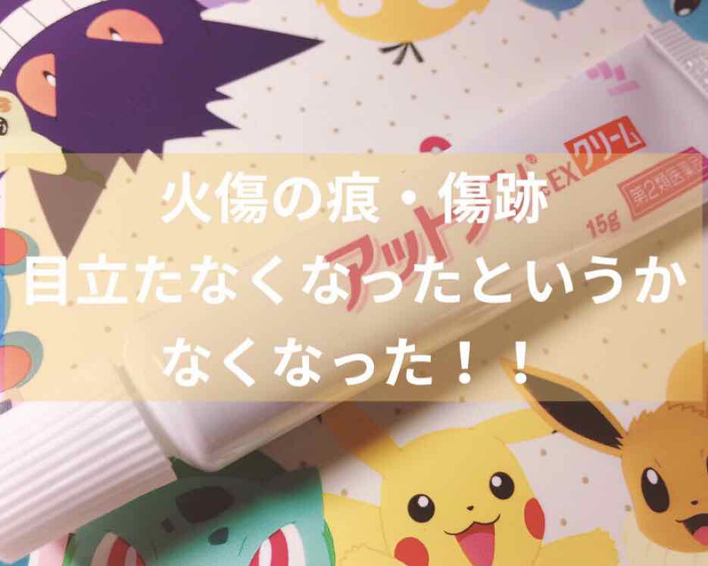 アットノンEX クリーム(医薬品)/アットノン/その他を使ったクチコミ（1枚目）