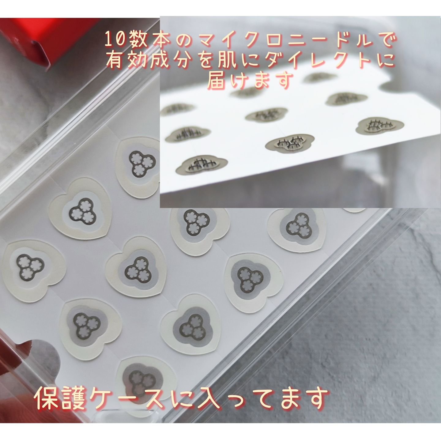 ACマグネシウムパッチ　ミニ/スノーツープラス/にきびパッチを使ったクチコミ（3枚目）