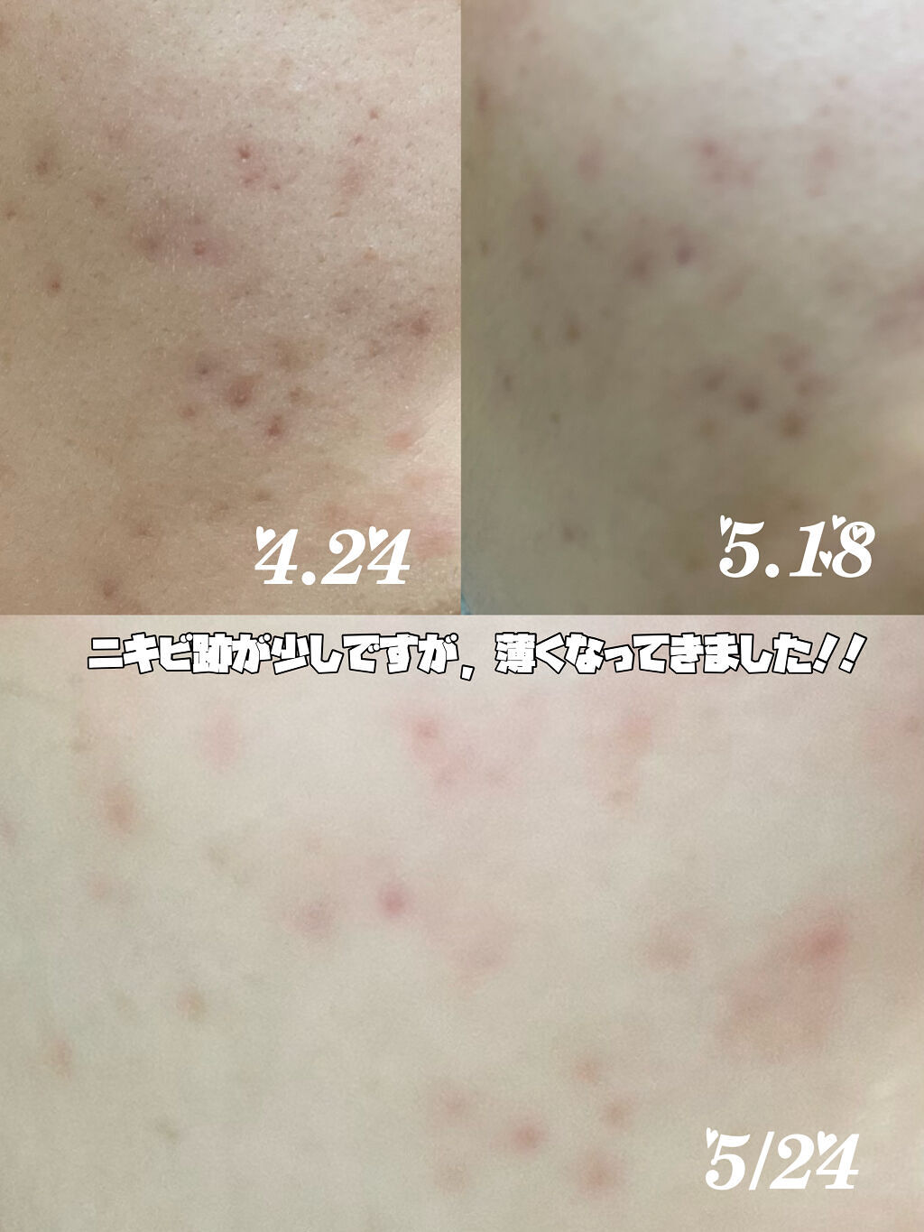 薬用しみ集中対策 プレミアム美容液/メラノCC/美容液を使ったクチコミ（3枚目）