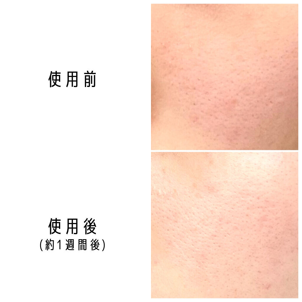 お米の化粧水/毛穴撫子/化粧水を使ったクチコミ（3枚目）