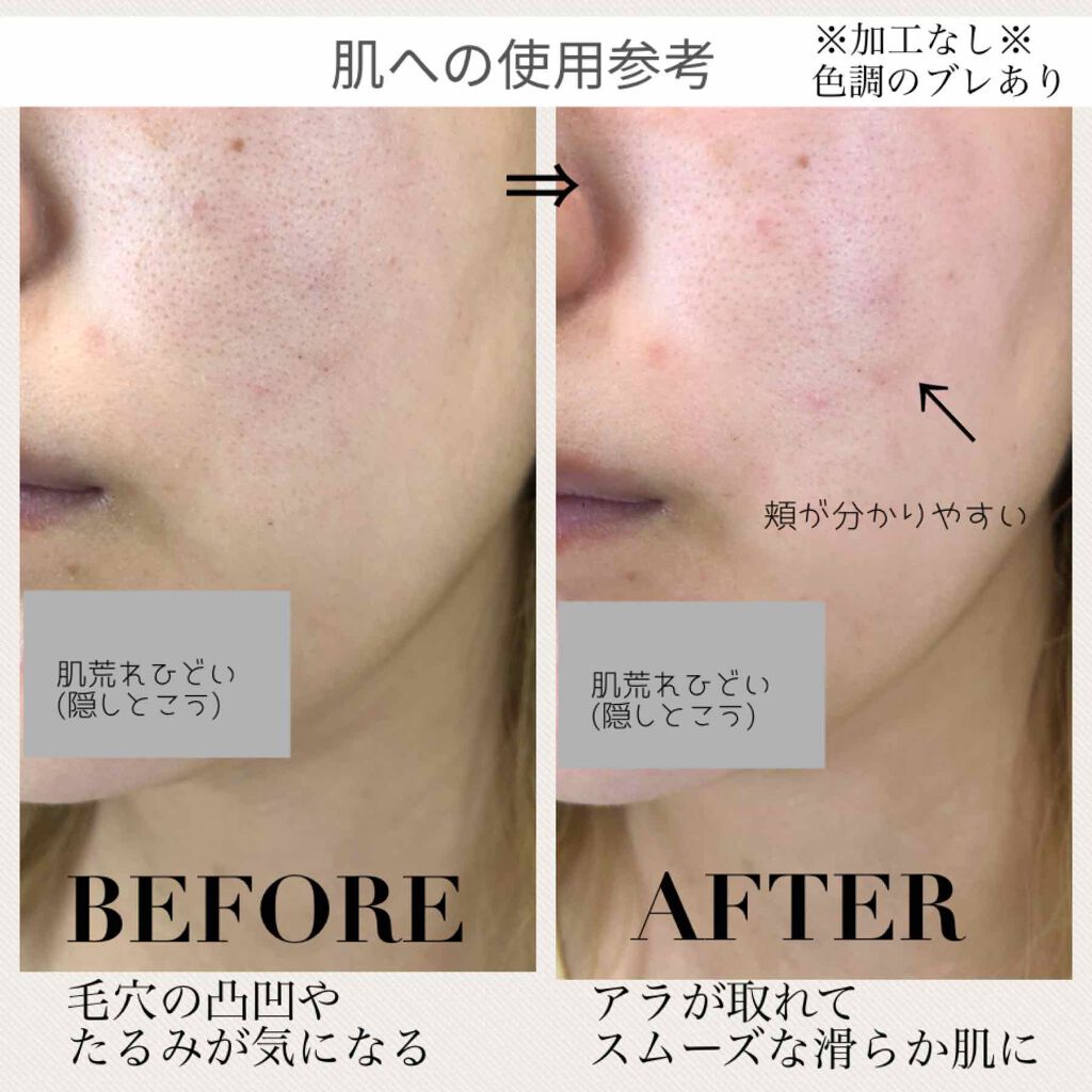 スムースEクリーム/SMOOTH E/フェイスクリームを使ったクチコミ(3枚目)