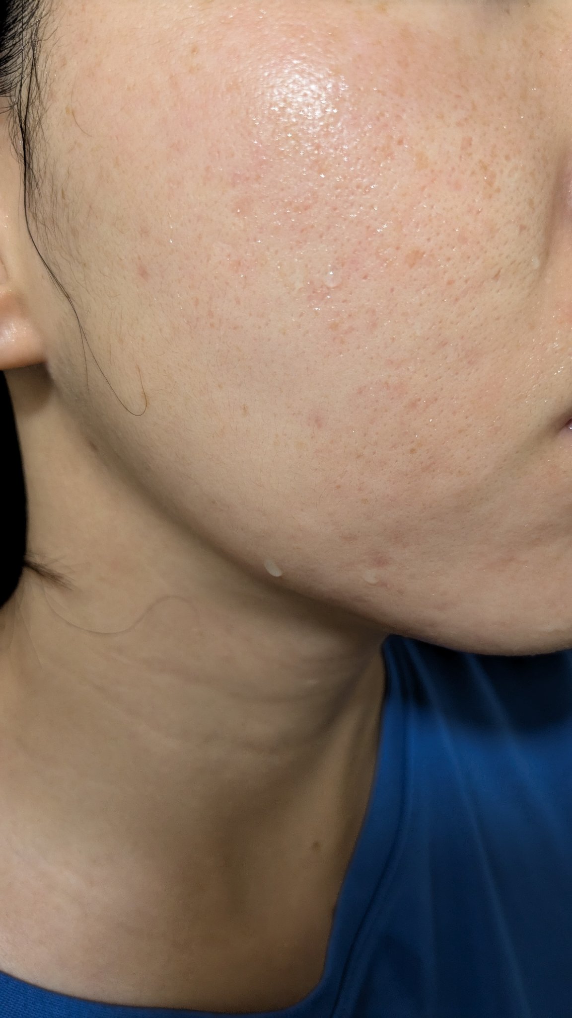 クリーム NC/なめらか本舗/フェイスクリームを使ったクチコミ（1枚目）