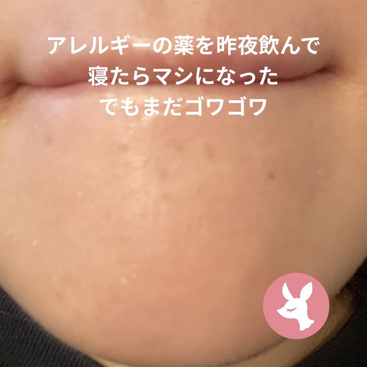 ティーツリーカーミングエッセンスパッド/MEDIHEAL/トナーパッドを使ったクチコミ（2枚目）