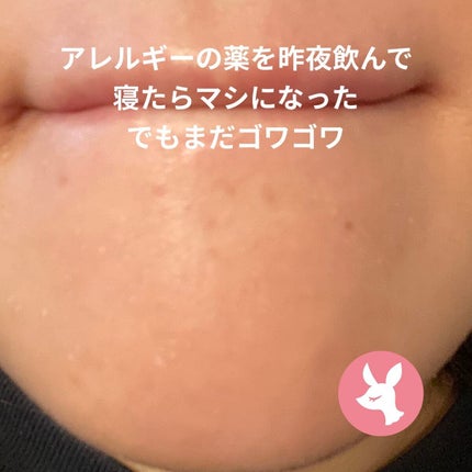 ティーツリーカーミングエッセンスパッド/MEDIHEAL/トナーパッドを使ったクチコミ(2枚目)