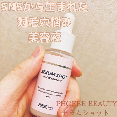 PHOEBE BEAUTY UPのSERUM SHOT(美容液)
を定期購入して肌が変わった点をご紹介致します。
この美容液はヒト幹細胞が入っており、保湿力が抜群に上がります。
毛穴開き、毛穴を集中的に