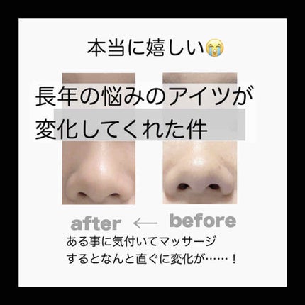 田代 on LIPS 「鼻にお悩みを持っていたら少しでも見てほしい!!!私は中学の頃か..」(1枚目)