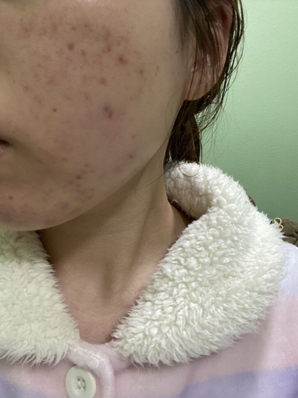 ホットクレンジングゲル/マナラ/クレンジングジェルを使ったクチコミ（3枚目）