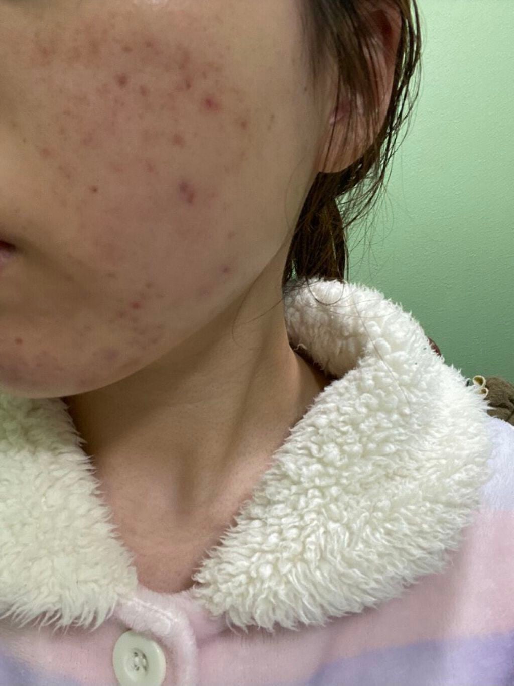 ホットクレンジングゲル/マナラ/クレンジングジェルを使ったクチコミ(3枚目)