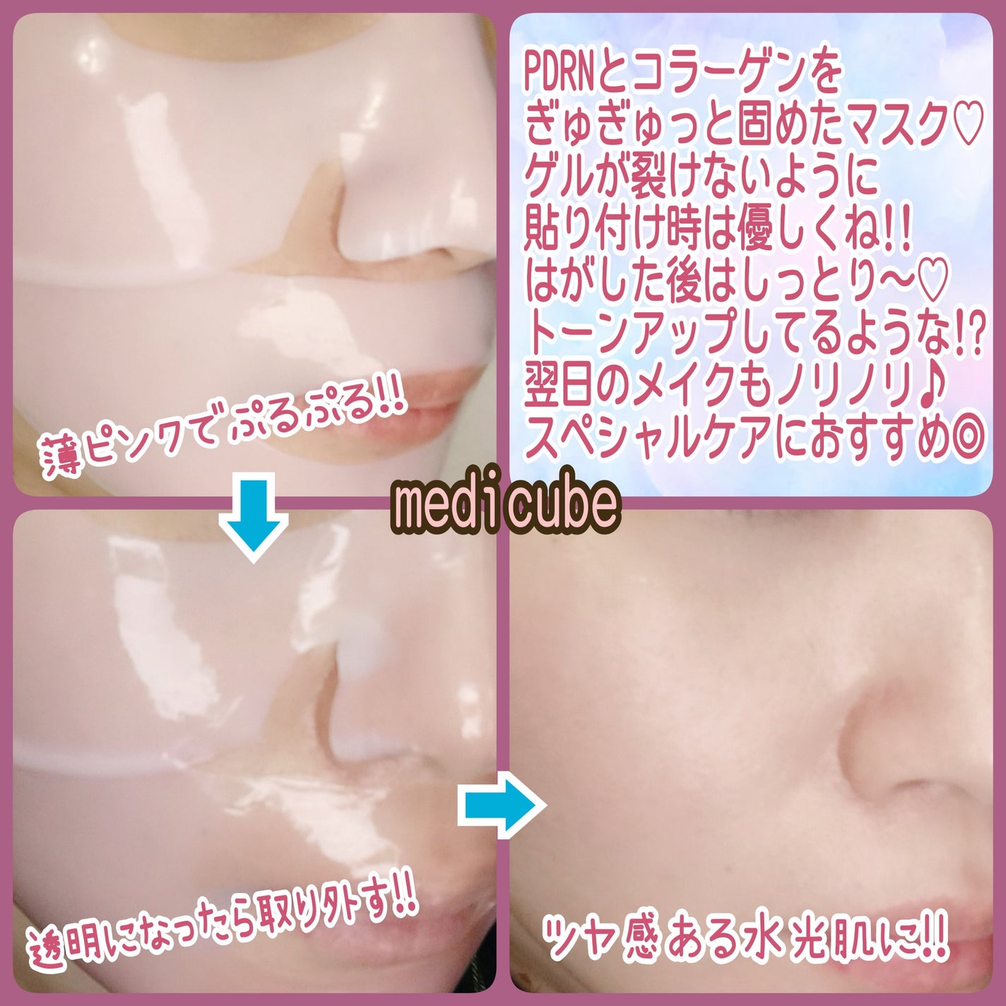 PDRNピンクコラーゲンゲルマスク/MEDICUBE/シートマスク・パックを使ったクチコミ(2枚目)
