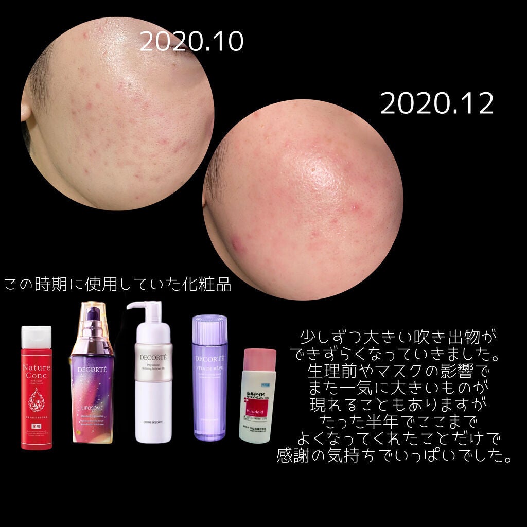 モイストバランス ローション/ACSEINE/化粧水を使ったクチコミ(5枚目)