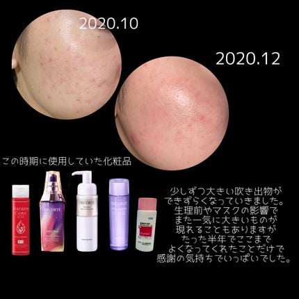 モイストバランス ローション/ACSEINE/化粧水を使ったクチコミ(5枚目)