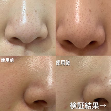 エマルジョンリムーバー 300ml/200ml/水橋保寿堂製薬/その他洗顔料を使ったクチコミ(5枚目)