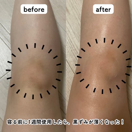 BnDアンダーアームクリーム(ボディクリーム)/BnD/デリケートゾーンケアを使ったクチコミ(4枚目)