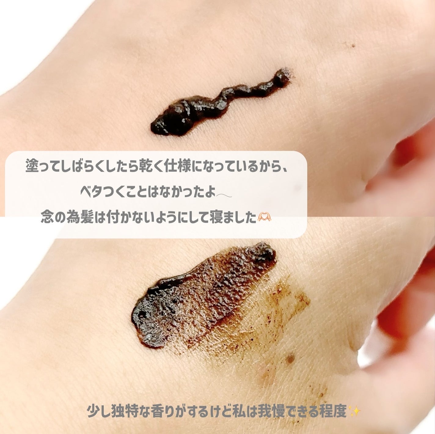 ダーマスキンピーリング/BQCELL/その他キットセットを使ったクチコミ(3枚目)