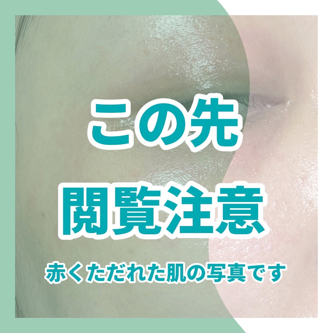 レッドブレミッシュ クリアスージングクリーム/Dr.G/フェイスクリームを使ったクチコミ(5枚目)