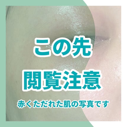 レッドブレミッシュ クリアスージングクリーム/Dr.G/フェイスクリームを使ったクチコミ(5枚目)